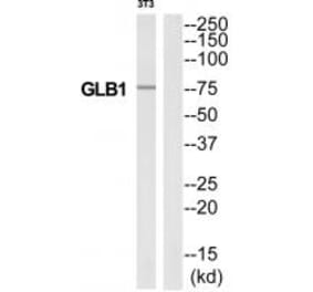 Western blot - GLB1 Antibody from Signalway Antibody (34494) - Antibodies.com