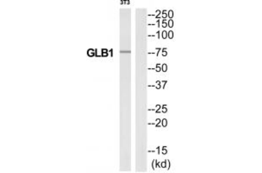 Western blot - GLB1 Antibody from Signalway Antibody (34494) - Antibodies.com
