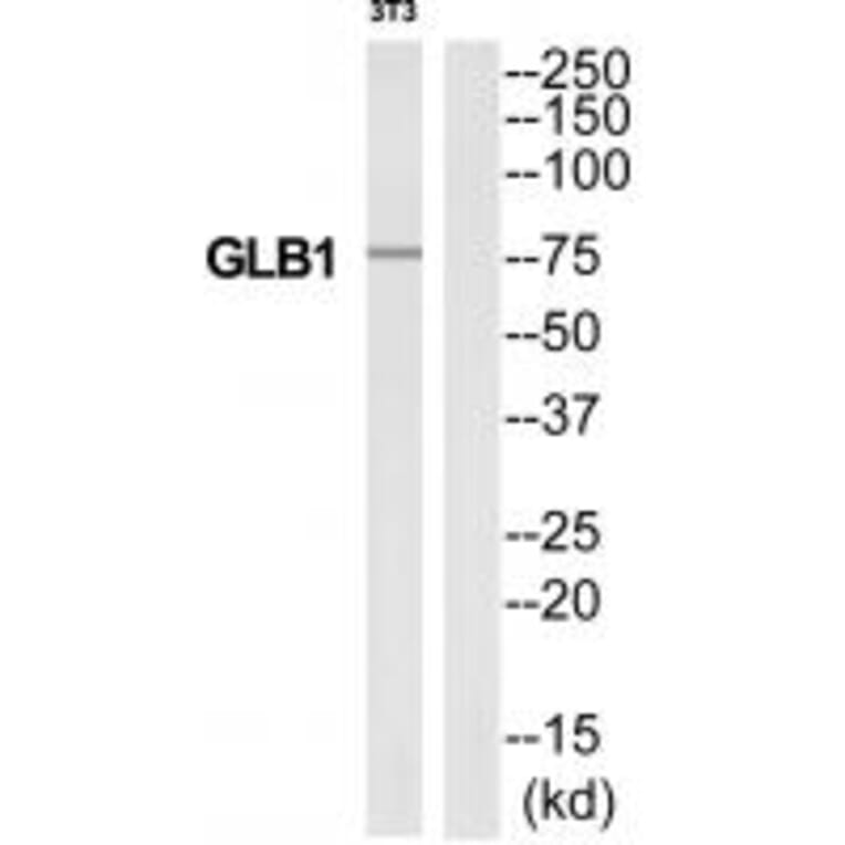 Western blot - GLB1 Antibody from Signalway Antibody (34494) - Antibodies.com