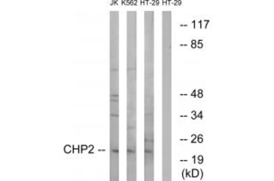 Western blot - CHP2 Antibody from Signalway Antibody (34512) - Antibodies.com