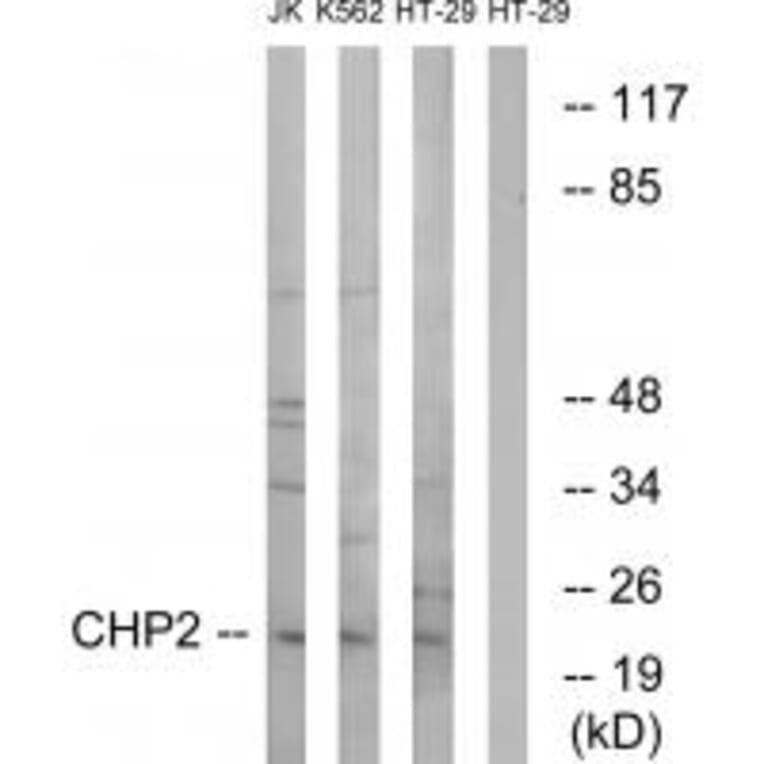 Western blot - CHP2 Antibody from Signalway Antibody (34512) - Antibodies.com