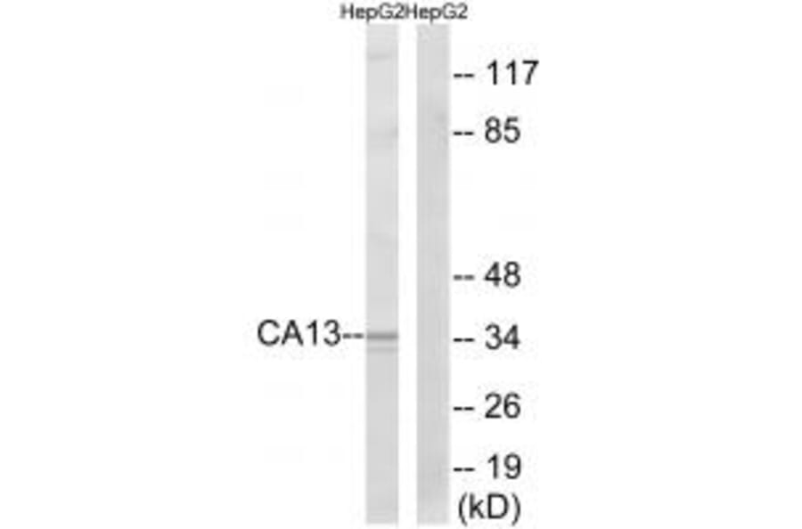 Western blot - CA13 Antibody from Signalway Antibody (34538) - Antibodies.com