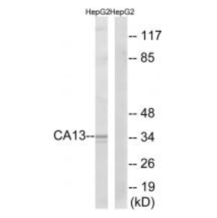 Western blot - CA13 Antibody from Signalway Antibody (34538) - Antibodies.com