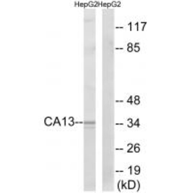 Western blot - CA13 Antibody from Signalway Antibody (34538) - Antibodies.com