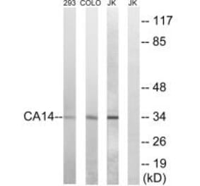 Western blot - CA14 Antibody from Signalway Antibody (34539) - Antibodies.com