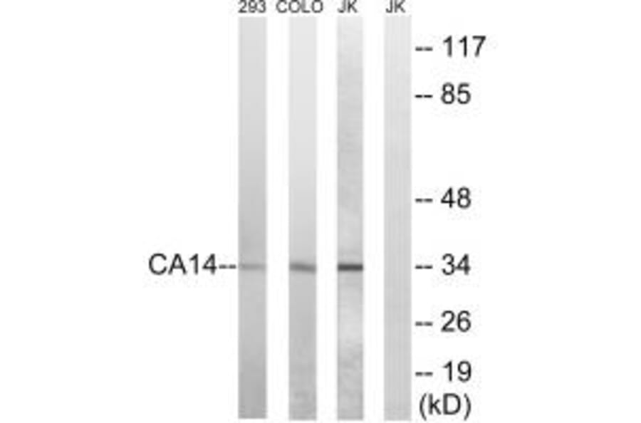 Western blot - CA14 Antibody from Signalway Antibody (34539) - Antibodies.com