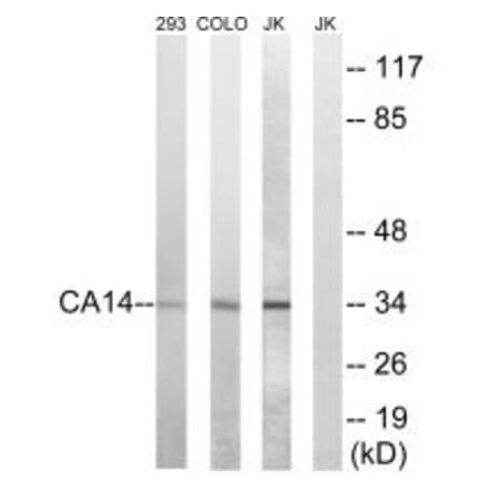 Western blot - CA14 Antibody from Signalway Antibody (34539) - Antibodies.com