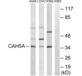 Western blot - CA5A Antibody from Signalway Antibody (34541) - Antibodies.com