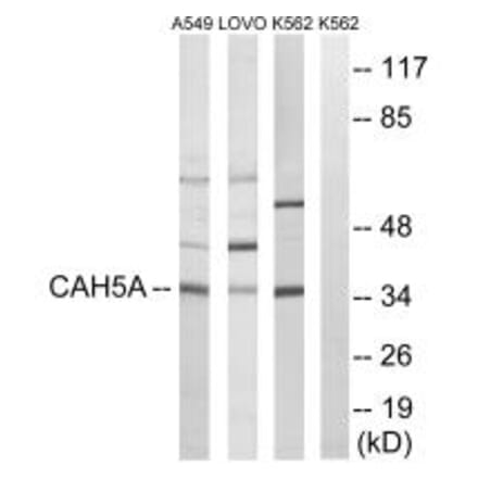 Western blot - CA5A Antibody from Signalway Antibody (34541) - Antibodies.com