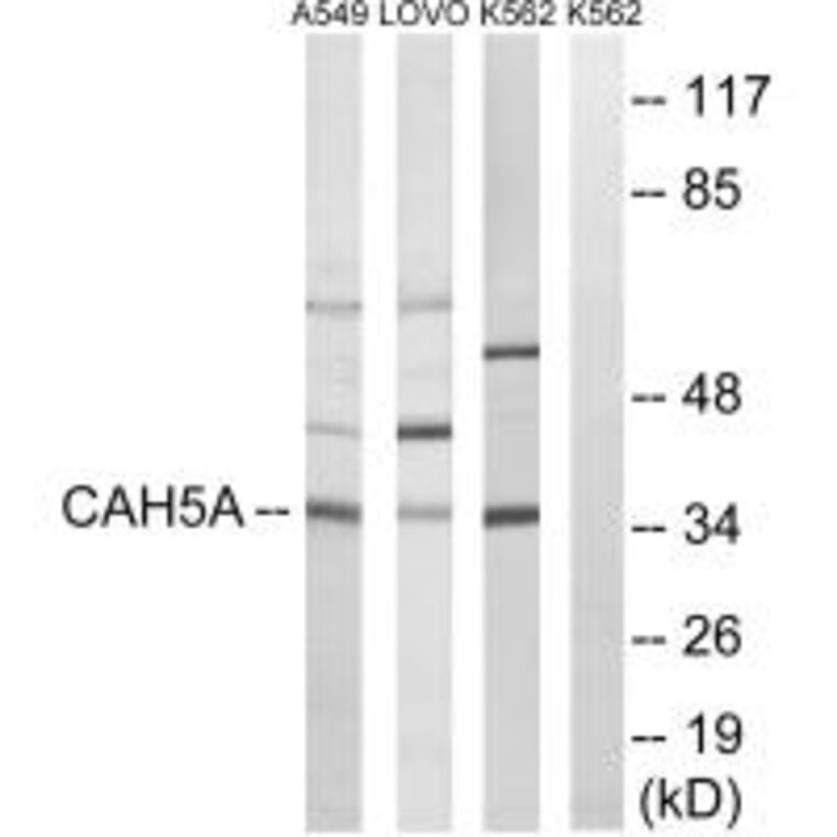 Western blot - CA5A Antibody from Signalway Antibody (34541) - Antibodies.com