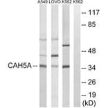Western blot - CA5A Antibody from Signalway Antibody (34541) - Antibodies.com