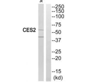 Western blot - CES2 Antibody from Signalway Antibody (34546) - Antibodies.com