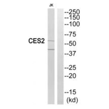 Western blot - CES2 Antibody from Signalway Antibody (34546) - Antibodies.com