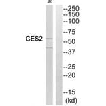 Western blot - CES2 Antibody from Signalway Antibody (34546) - Antibodies.com