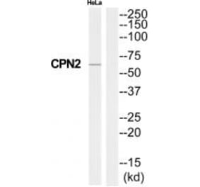 Western blot - CPN2 Antibody from Signalway Antibody (34551) - Antibodies.com