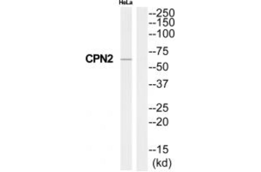 Western blot - CPN2 Antibody from Signalway Antibody (34551) - Antibodies.com