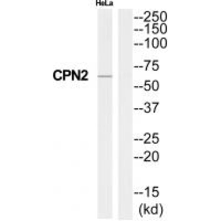 Western blot - CPN2 Antibody from Signalway Antibody (34551) - Antibodies.com