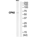 Western blot - CPN2 Antibody from Signalway Antibody (34551) - Antibodies.com