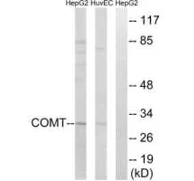 Western blot - COMT Antibody from Signalway Antibody (34554) - Antibodies.com