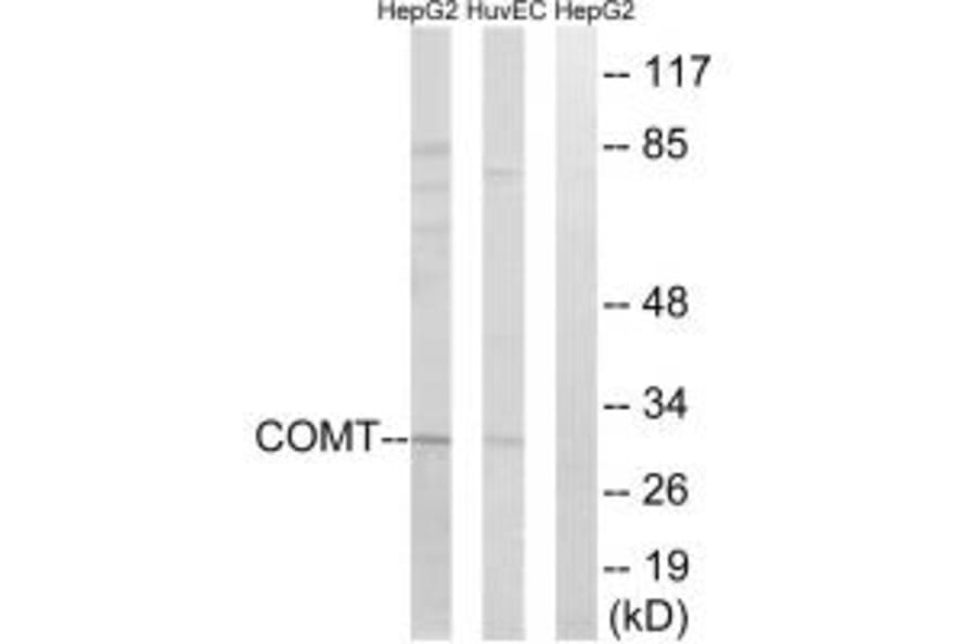 Western blot - COMT Antibody from Signalway Antibody (34554) - Antibodies.com