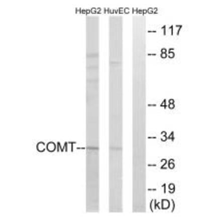 Western blot - COMT Antibody from Signalway Antibody (34554) - Antibodies.com