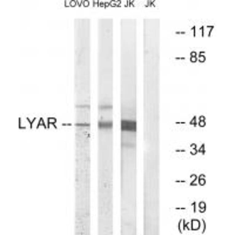 Western blot - LYAR Antibody from Signalway Antibody (34561) - Antibodies.com