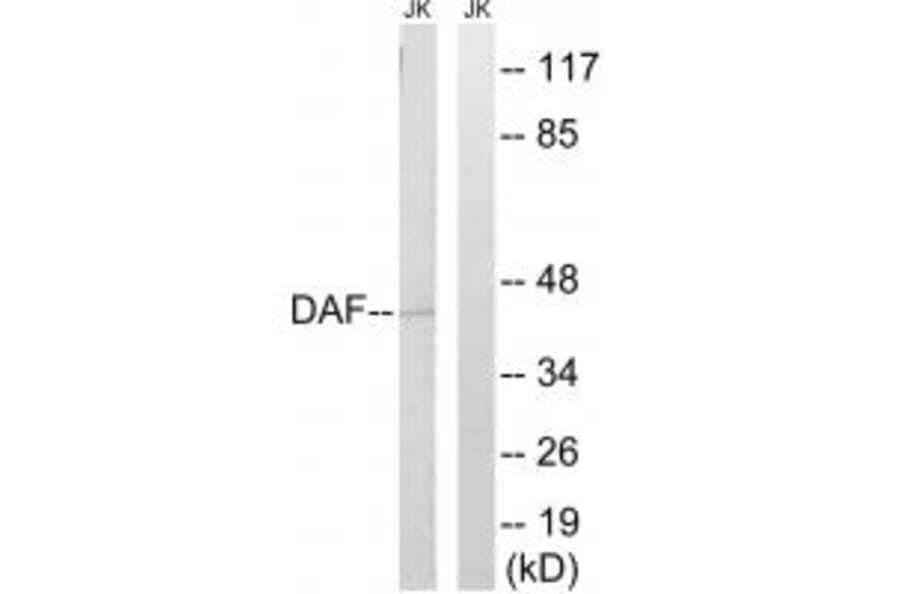 Western blot - CD55 Antibody from Signalway Antibody (34613) - Antibodies.com
