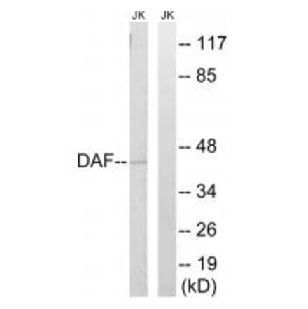 Western blot - CD55 Antibody from Signalway Antibody (34613) - Antibodies.com
