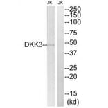 Western blot - DKK3 Antibody from Signalway Antibody (34645) - Antibodies.com