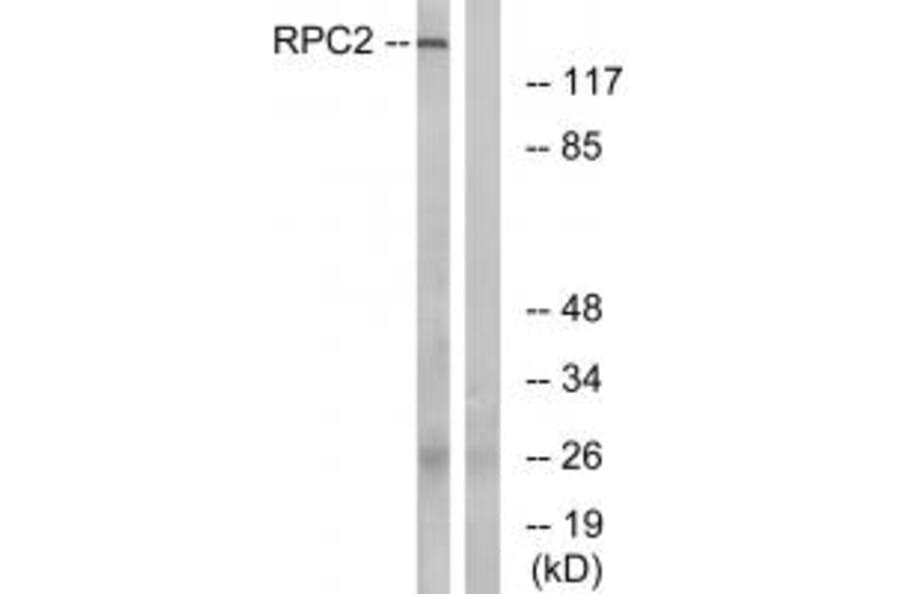 Western blot - RPC2 Antibody from Signalway Antibody (34653) - Antibodies.com