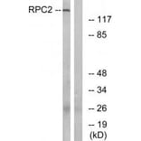 Western blot - RPC2 Antibody from Signalway Antibody (34653) - Antibodies.com
