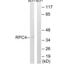 Western blot - RPC4 Antibody from Signalway Antibody (34655) - Antibodies.com