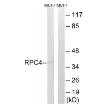 Western blot - RPC4 Antibody from Signalway Antibody (34655) - Antibodies.com