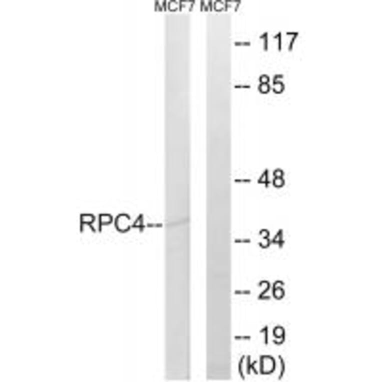 Western blot - RPC4 Antibody from Signalway Antibody (34655) - Antibodies.com