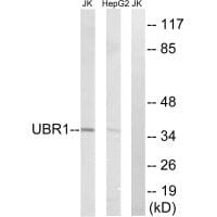 Western blot analysis of extracts from Jurkat cells and HepG2 cells, using UBR1 antibody #34664.