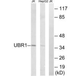 Western blot - UBR1 Antibody from Signalway Antibody (34664) - Antibodies.com