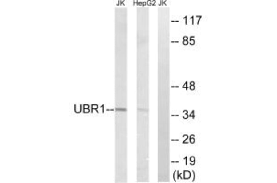 Western blot - UBR1 Antibody from Signalway Antibody (34664) - Antibodies.com