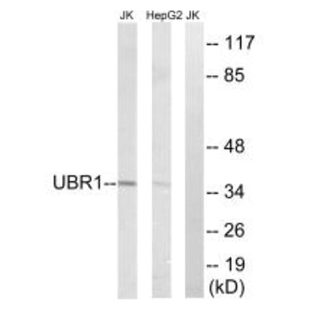 Western blot - UBR1 Antibody from Signalway Antibody (34664) - Antibodies.com