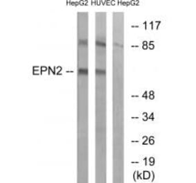 Western blot - EPN2 Antibody from Signalway Antibody (34677) - Antibodies.com