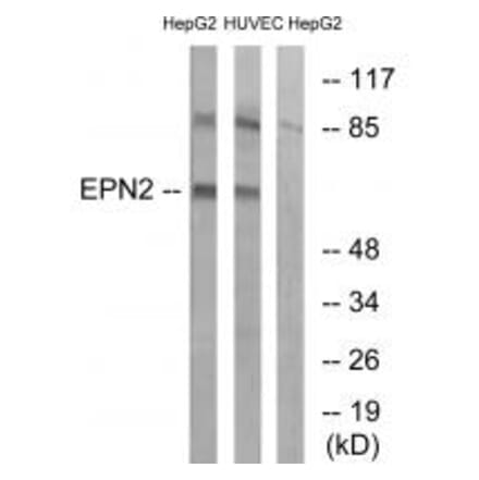 Western blot - EPN2 Antibody from Signalway Antibody (34677) - Antibodies.com