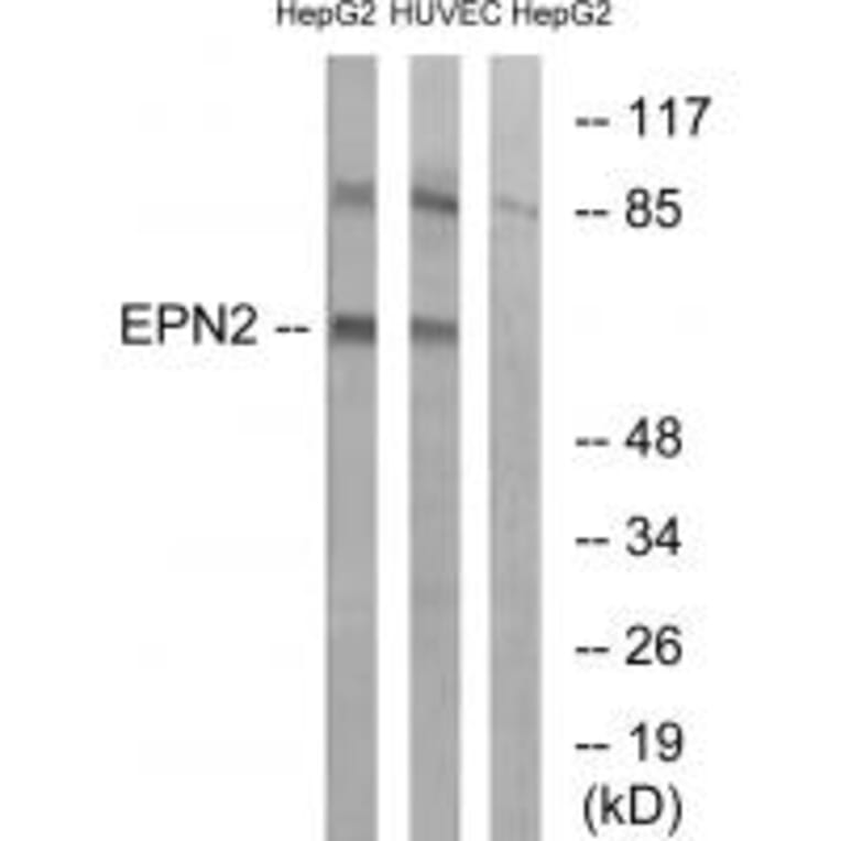 Western blot - EPN2 Antibody from Signalway Antibody (34677) - Antibodies.com