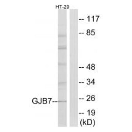 Western blot - GJB7 Antibody from Signalway Antibody (34701) - Antibodies.com