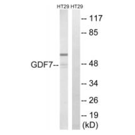 Western blot - GDF7 Antibody from Signalway Antibody (34713) - Antibodies.com