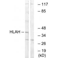Western blot analysis of extracts from LOVO cells, using HLAH antibody #34734.