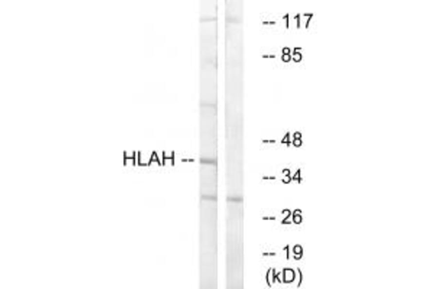 Western blot - HLAH Antibody from Signalway Antibody (34734) - Antibodies.com