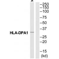 Western blot analysis of extracts from Jurkat cells, using HA2Q antibody #34737.