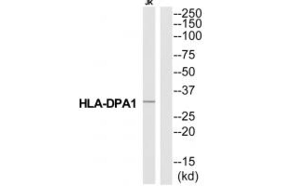 Western blot - HA2Q Antibody from Signalway Antibody (34737) - Antibodies.com