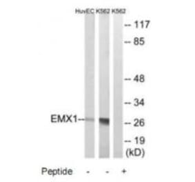 Western blot - EMX1 Antibody from Signalway Antibody (34738) - Antibodies.com