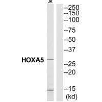 Western blot analysis of extracts from Jurkat cells, using HXA5 antibody #34740.