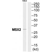 Western blot analysis of extracts from COLO205 cells, using MSX2 antibody #34744.